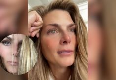 ¿Qué le pasó en el ojo a Montserrat Oliver?, ella revela lo que pasó