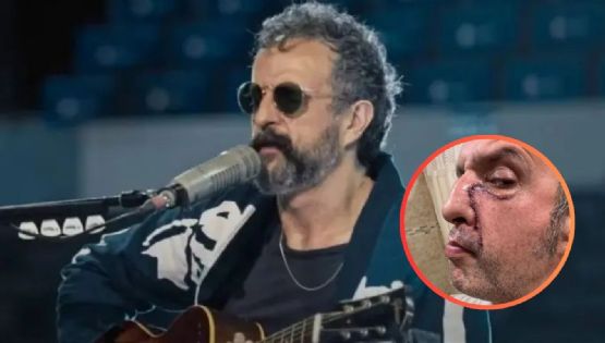 Tito Fuentes rompe el silencio y muestra las secuelas de las drogas en su rostro