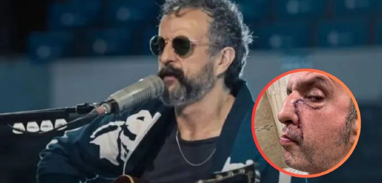 Tito Fuentes rompe el silencio y muestra las secuelas de las drogas en su rostro