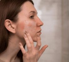 Cómo prevenir las manchas en la cara; hábitos diarios que protegen tu piel