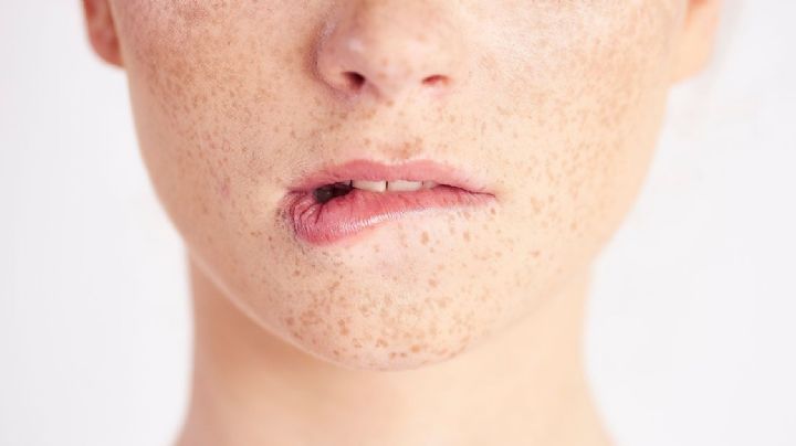 Qué vitamina falta cuando se te parten los labios; señales que el cuerpo envía y no hay que ignorar