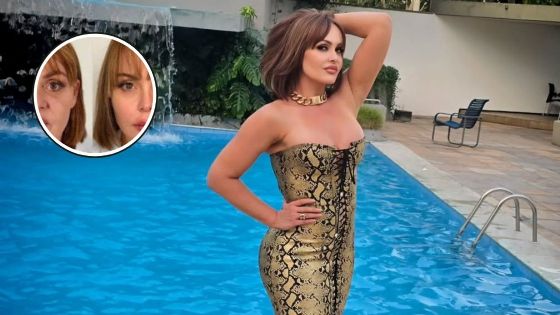 Gaby Spanic causa revuelo con su rejuvenecimiento extremo; estos son los procedimientos que se hizo