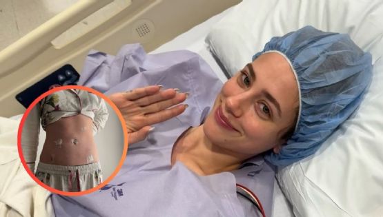 Lili Reinhart fue sometida a cirugía; su testimonio recibe una ola de apoyo