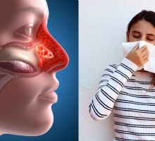 Formas naturales de reducir la congestión nasal de manera rápida y efectiva