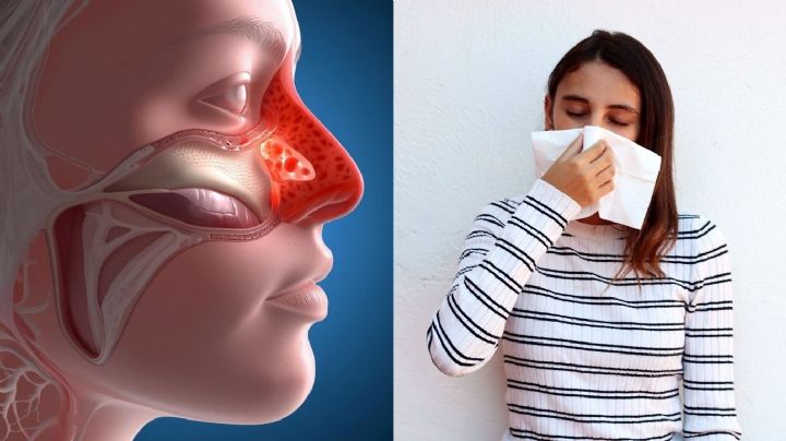 Formas naturales de reducir la congestión nasal de manera rápida y efectiva