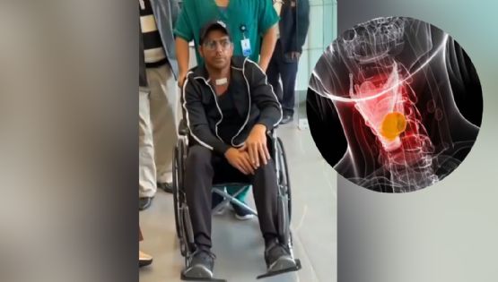 Paulo Quevedo: este es su estado de salud tras ser operado por cáncer