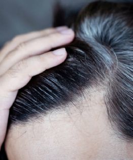 ¿Tu cabello se volvió blanco de pronto? El estrés podría ser la causa