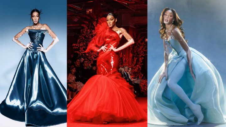 Winnie Harlow y el vitiligo: una historia de orgullo, visibilidad y resiliencia en la moda
