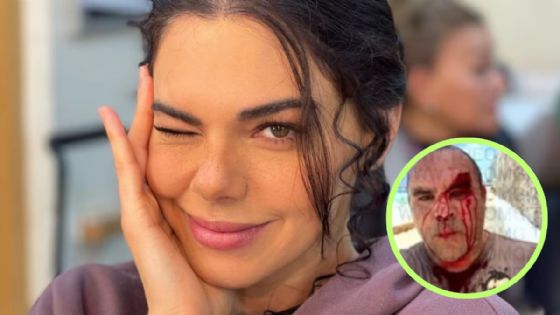 Livia Brito pierde juicio contra paparazzi y deberá pagar millonaria indemnización