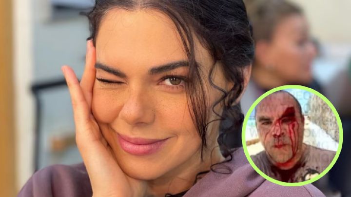 Livia Brito pierde juicio contra paparazzi y deberá pagar millonaria indemnización