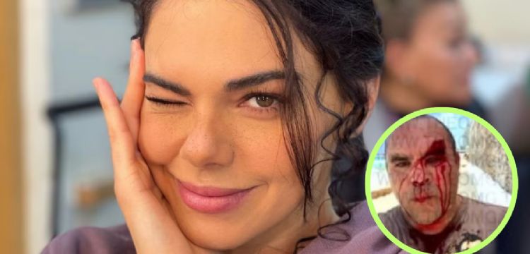 Livia Brito pierde juicio contra paparazzi y deberá pagar millonaria indemnización