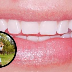 ¿Sonrisa de impacto? Descubre los alimentos cotidianos que hacen amarillos tus dientes