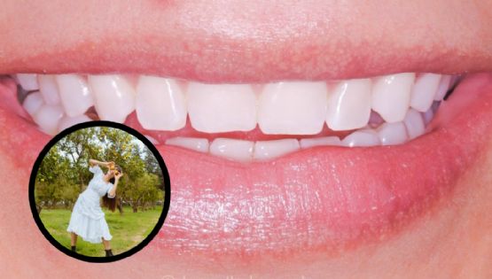 ¿Sonrisa de impacto? Descubre los alimentos cotidianos que hacen amarillos tus dientes