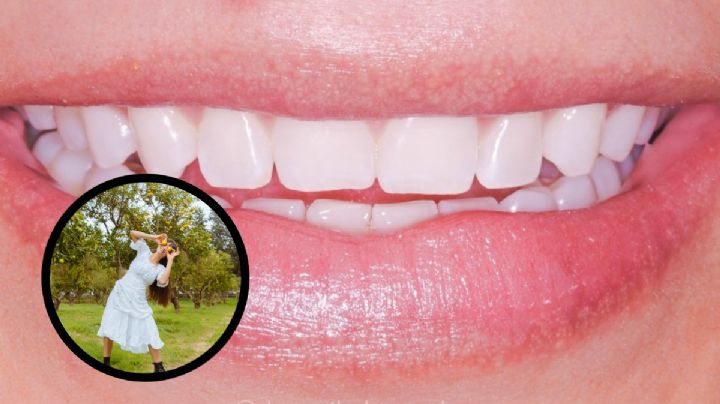 ¿Sonrisa de impacto? Descubre los alimentos cotidianos que hacen amarillos tus dientes