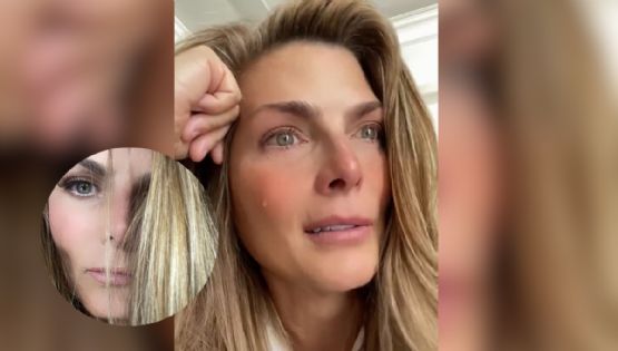 ¿Qué le pasó en el ojo a Montserrat Oliver?, ella revela lo que pasó