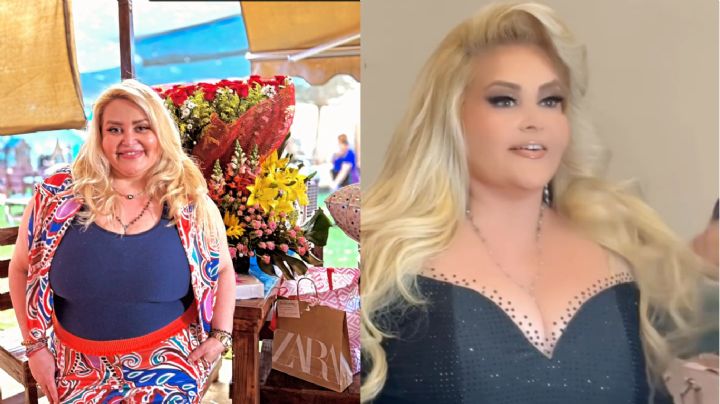 Sheyla transforma su cambio físico en esperanza; dona 8 kilos de piel a niños con quemaduras