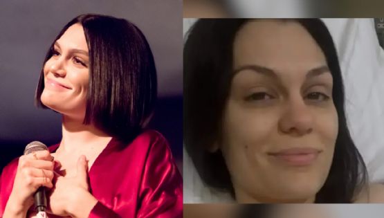 Jessie J regresa al quirófano tras complicaciones médicas; esta es la batalla que enfrenta | VIDEO