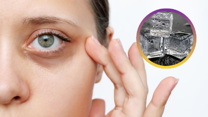 Adiós ojeras: descubre estos métodos naturales para borrarlas sin maquillaje