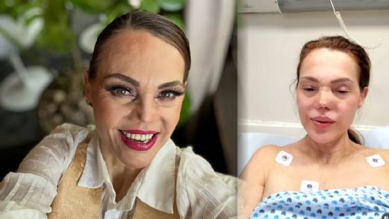 Carmen Campuzano es hospitalizada tras accidente y es intervenida; esto es lo que sabemos | VIDEO