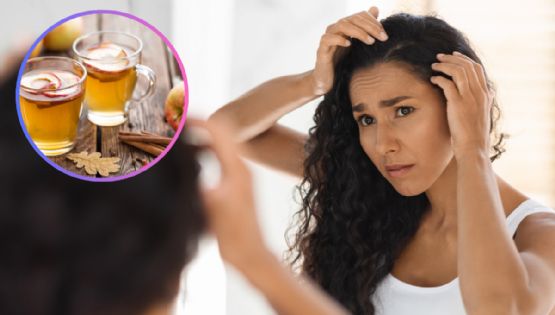Cómo eliminar la caspa rápido: el remedio casero más popular que funciona mejor que muchos shampoos