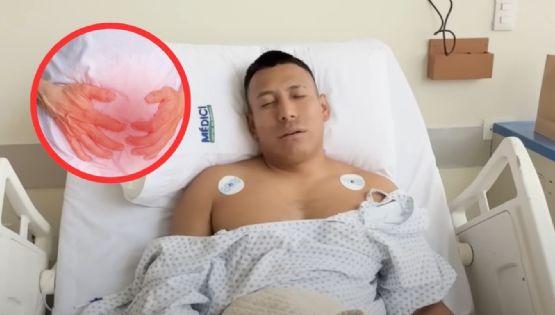 'Puedes morir': Yulay revela el grave diagnóstico que lo llevó a una operación de emergencia