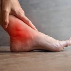 Remedios caseros para reducir el ácido úrico; tratamientos naturales que realmente funcionan